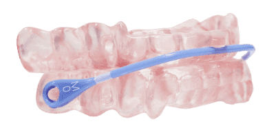 Somnomed Avant oral appliance