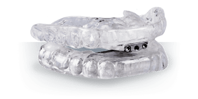 Thornton Adjustable Positioner oral appliance