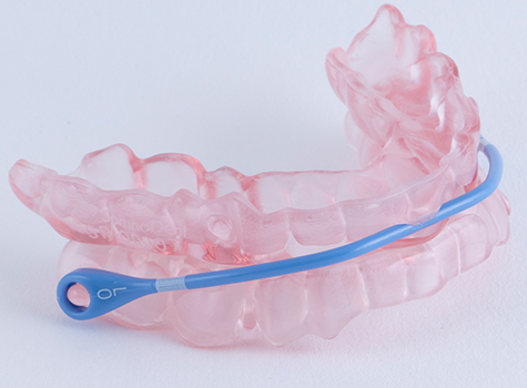 Close up of oral appliance