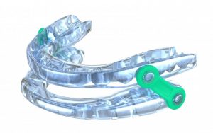 closeup of an oral appliance