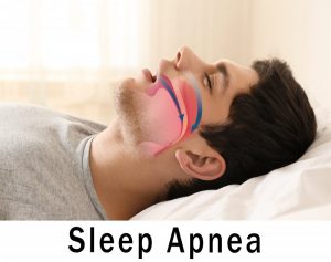 man with sleep apnea that won't go away