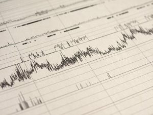 results of a sleep test