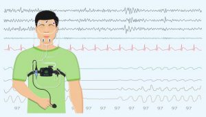 illustration of a patient undergoing a sleep study